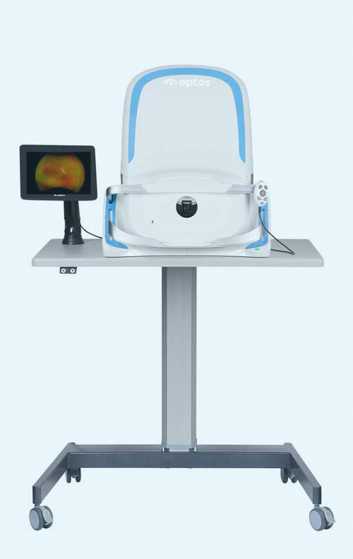 Optomap California On-Table